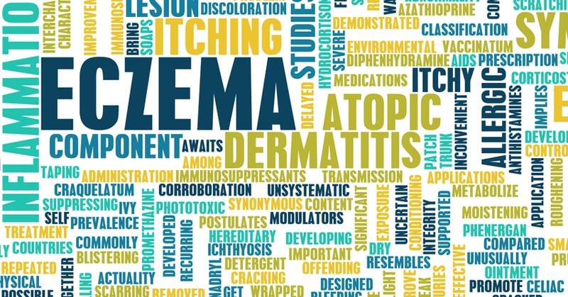 4 Ways to Heal Your Eczema