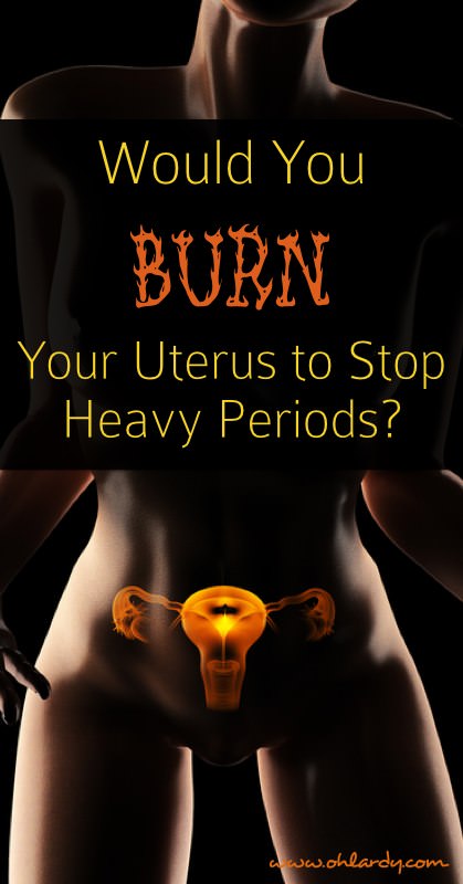 Don't burn your uterus to stop your heavy periods! Read why you should not undergo endometrial ablation. Treat your hormonal imbalance naturally!